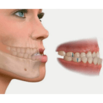 cirugia bucal maxilofacial interlomas cdmx mexico marion ormeno