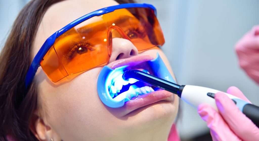 Todo lo que necesitas saber sobre blanqueamiento dental