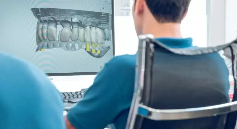 Impresión 3d odontología
