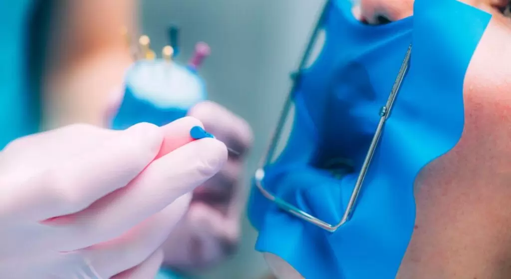 Endodoncia: mitos, realidades y qué esperar del procedimiento