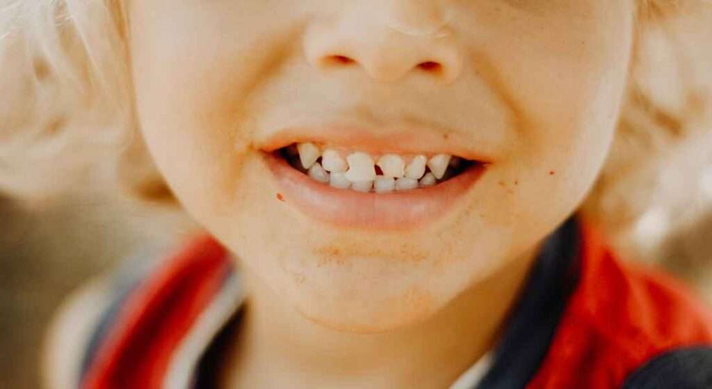 Niño sonriendo con espacios normales entre los dientes de leche