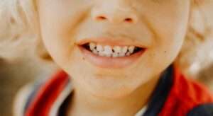 Niño sonriendo con espacios normales entre los dientes de leche