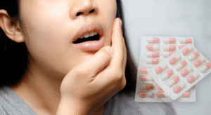 Los antibióticos quitan el dolor de muela